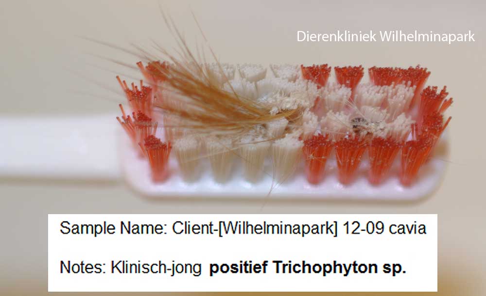 De PCR van het tandenborstel monster geeft een schimmel infectie aan